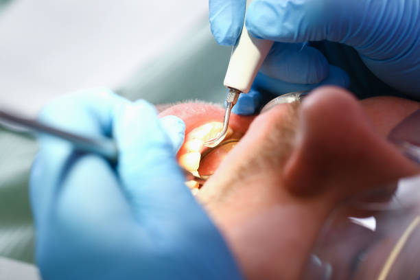 Best Emergency Gum Treatment in Jacksboro, TX