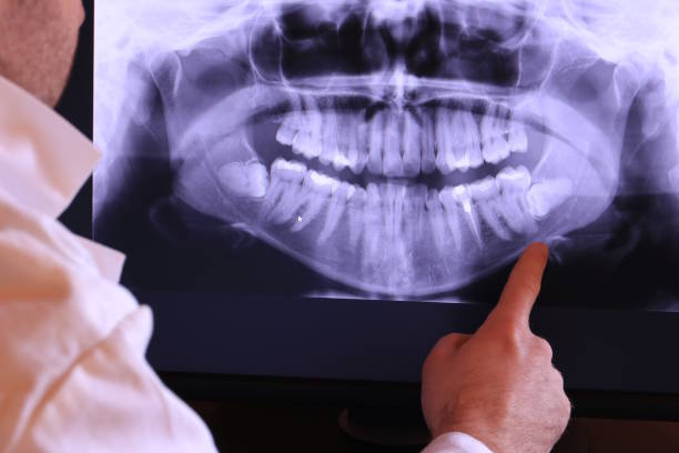 Best Weekend Emergency Dentist in Jacksboro, TX